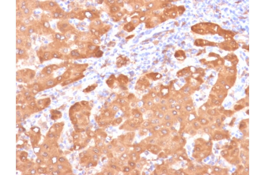 Immunohistochemistry - Anti-ALDH1A1 Antibody [ALDH1A1/4793] (A248523) - Antibodies.com