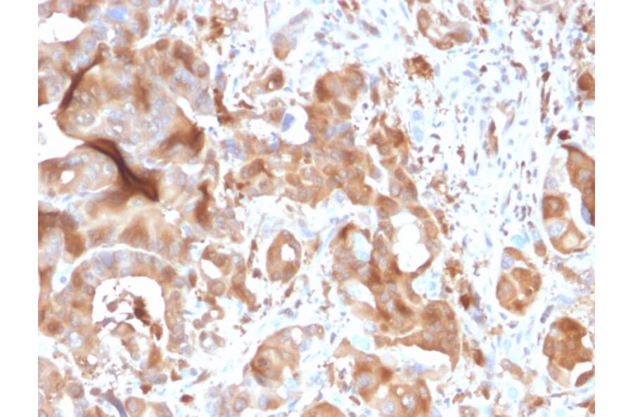 Immunohistochemistry - Anti-FABP5 Antibody [CPTC-FABP5-3] (A248523) - Antibodies.com