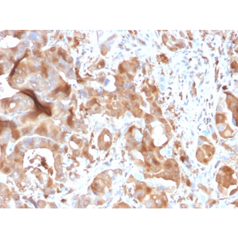 Immunohistochemistry - Anti-FABP5 Antibody [CPTC-FABP5-3] (A248523) - Antibodies.com