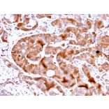 Immunohistochemistry - Anti-FABP5 Antibody [FABP5/3750] (A248525) - Antibodies.com