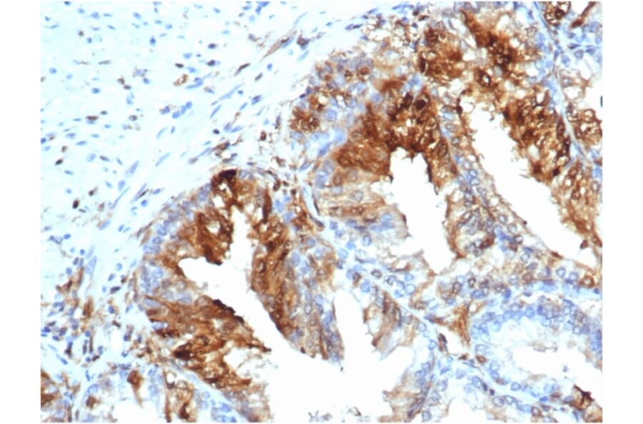 Immunohistochemistry - Anti-FABP5 Antibody [rFABP5/6354] (A248526) - Antibodies.com