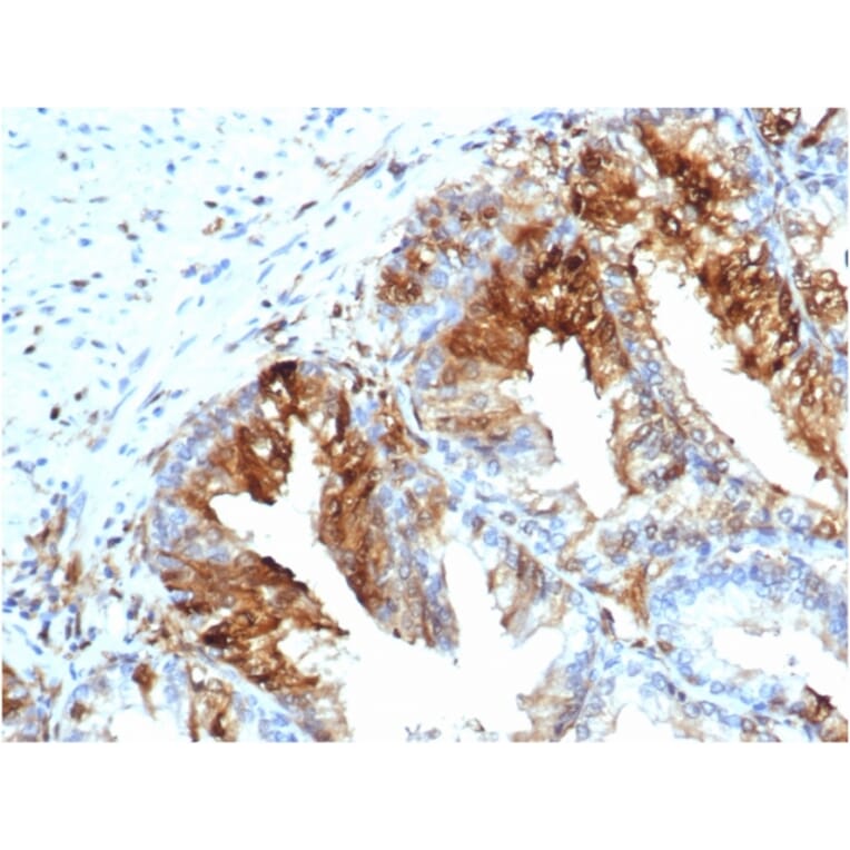 Immunohistochemistry - Anti-FABP5 Antibody [rFABP5/6354] (A248526) - Antibodies.com