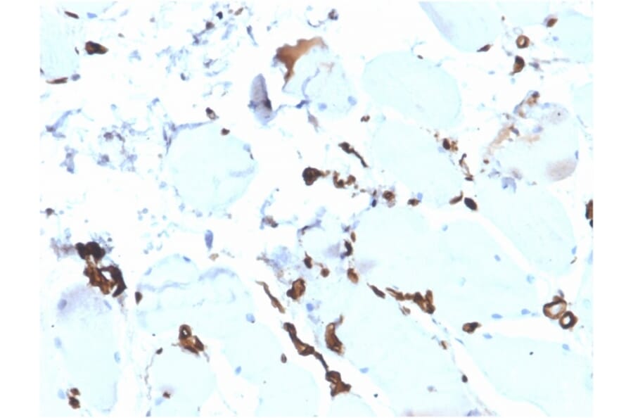 Immunohistochemistry - Anti-FABP5 Antibody [rFABP5/6354] (A248525) - Antibodies.com