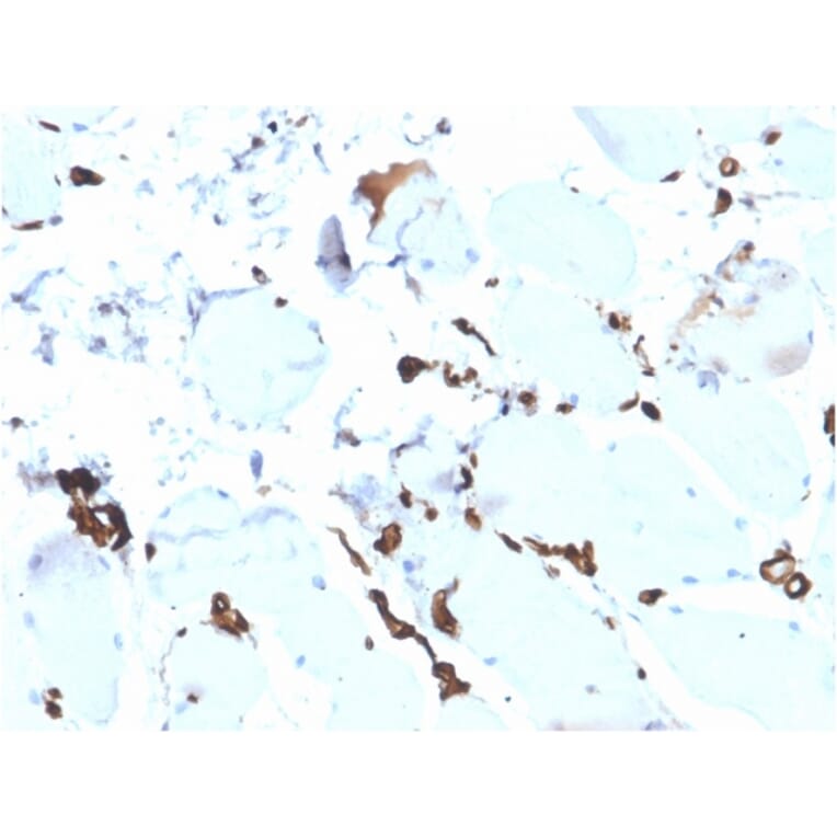 Immunohistochemistry - Anti-FABP5 Antibody [rFABP5/6354] (A248525) - Antibodies.com