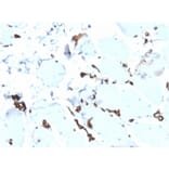 Immunohistochemistry - Anti-FABP5 Antibody [rFABP5/6354] (A248525) - Antibodies.com