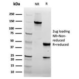 SDS-PAGE - Anti-FABP5 Antibody [rFABP5/6354] (A248526) - Antibodies.com