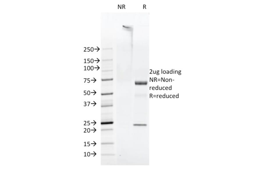 SDS-PAGE - Anti-FAT1 Antibody [FAT1-3D7/1] (A248526) - Antibodies.com