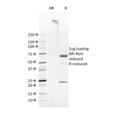 SDS-PAGE - Anti-FAT1 Antibody [FAT1-3D7/1] (A248526) - Antibodies.com