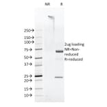 SDS-PAGE - Anti-FAT1 Antibody [FAT1-3D7/1] (A248526) - Antibodies.com