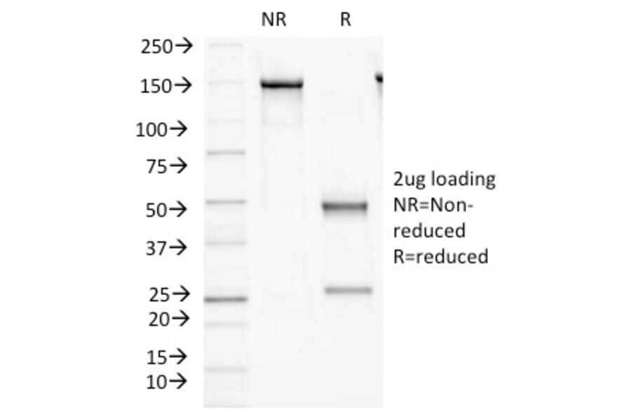 SDS-PAGE - Anti-FAT2 Antibody [8C5] (A248528) - Antibodies.com