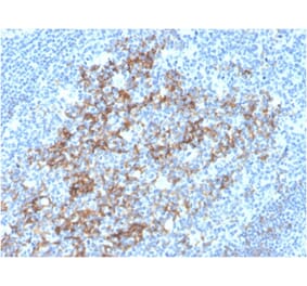Immunohistochemistry - Anti-CD23 Antibody [FCER2/3592] (A248529) - Antibodies.com