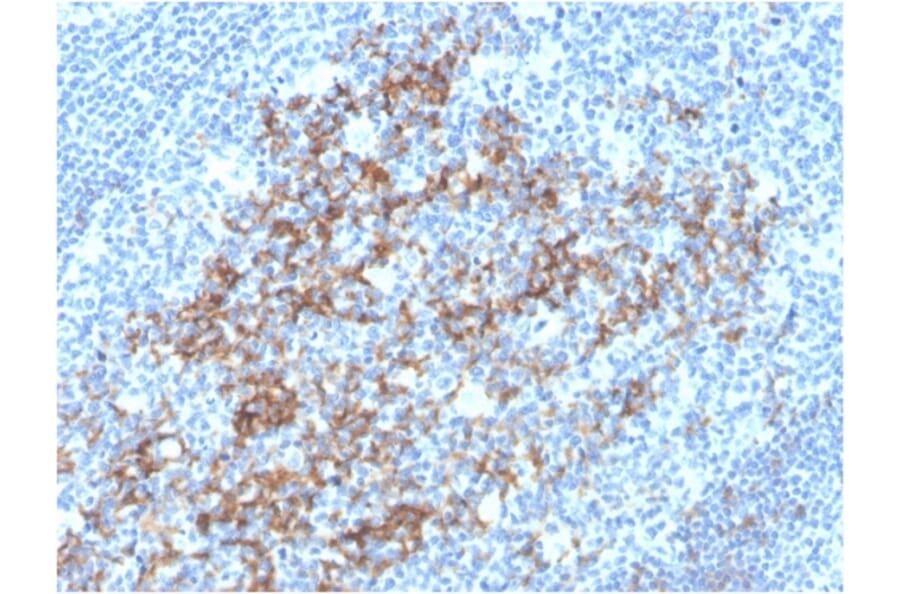 Immunohistochemistry - Anti-CD23 Antibody [FCER2/3592] (A248529) - Antibodies.com