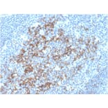 Immunohistochemistry - Anti-CD23 Antibody [FCER2/3592] (A248529) - Antibodies.com