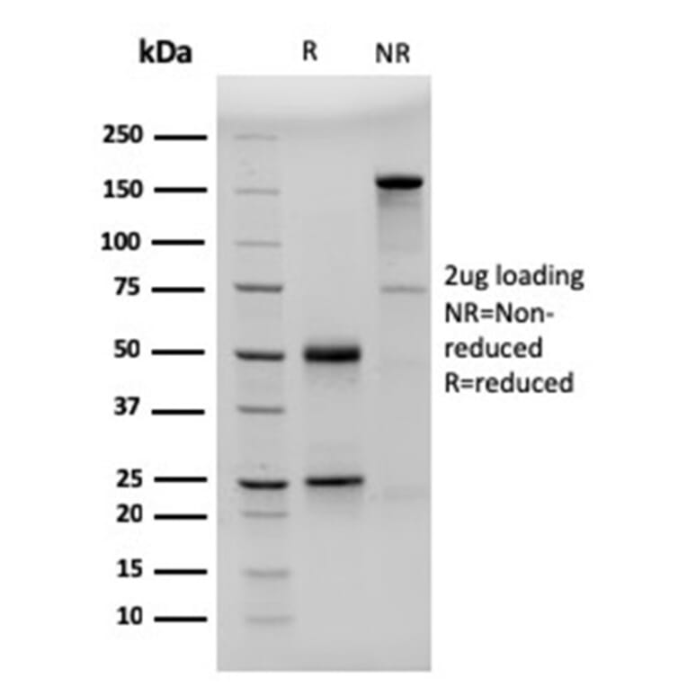 SDS-PAGE - Anti-CD23 Antibody [FCER2/3592] (A248529) - Antibodies.com