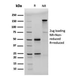 SDS-PAGE - Anti-CD23 Antibody [FCER2/3592] (A248529) - Antibodies.com