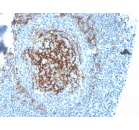 Immunohistochemistry - Anti-CD23 Antibody [FCER2/4395R] (A248530) - Antibodies.com