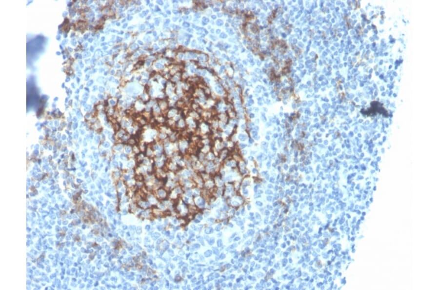 Immunohistochemistry - Anti-CD23 Antibody [FCER2/4395R] (A248530) - Antibodies.com