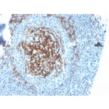Immunohistochemistry - Anti-CD23 Antibody [FCER2/4395R] (A248530) - Antibodies.com