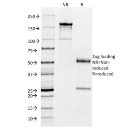 SDS-PAGE - Anti-CD32 Antibody [FCGR2A/479] (A248530) - Antibodies.com