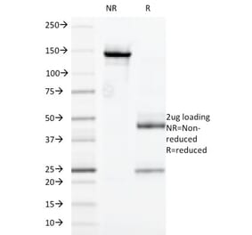 SDS-PAGE - Anti-CD32 Antibody [7.3] (A248532) - Antibodies.com