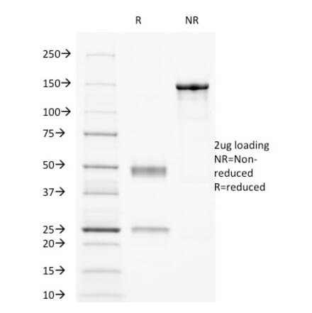 SDS-PAGE - Anti-CD32 Antibody [8.7] (A248533) - Antibodies.com