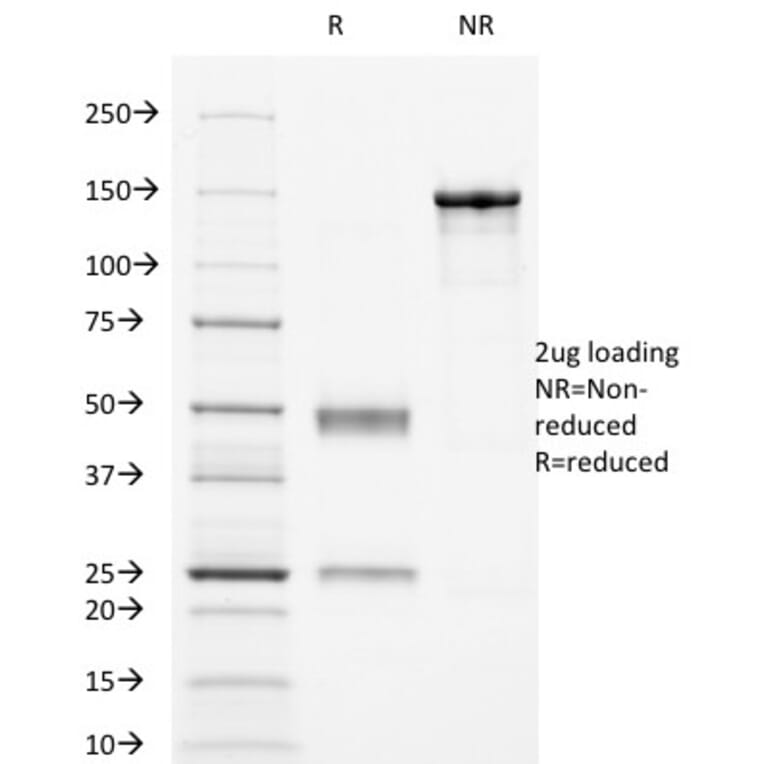SDS-PAGE - Anti-CD16 Antibody [HuNK2] (A248534) - Antibodies.com