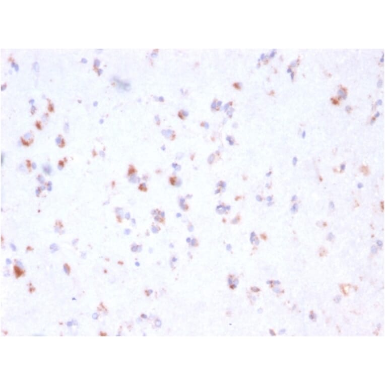 Immunohistochemistry - Anti-FCGRT Antibody [FCGRT/2932] (A248538) - Antibodies.com