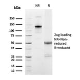 SDS-PAGE - Anti-FCGRT Antibody [FCGRT/2932] (A248538) - Antibodies.com