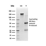 SDS-PAGE - Anti-SIRT2 Antibody [PCRP-SIRT2-1A8] (A248540) - Antibodies.com