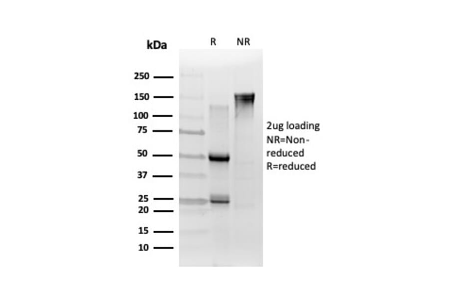 SDS-PAGE - Anti-TCF25 Antibody [PCRP-TCF25-1A11] (A248541) - Antibodies.com