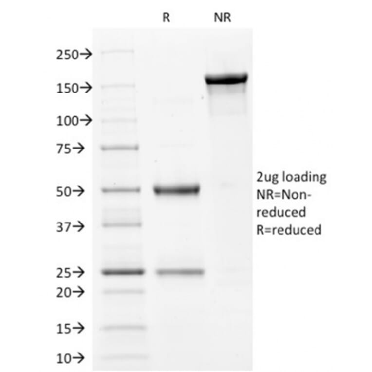 SDS-PAGE - Anti-Filaggrin Antibody [FLG/1561] (A248543) - Antibodies.com