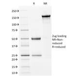 SDS-PAGE - Anti-Filaggrin Antibody [FLG/1561] (A248543) - Antibodies.com
