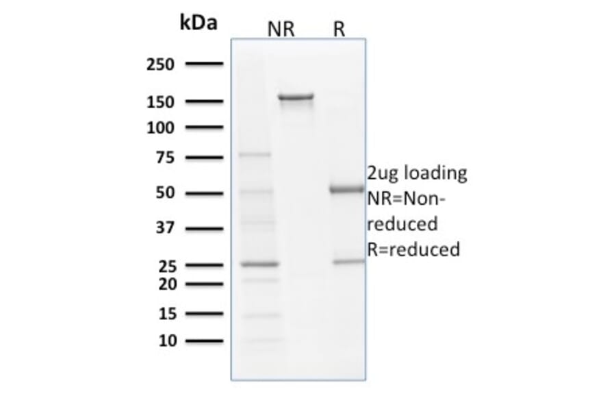 SDS-PAGE - Anti-Filaggrin Antibody [SPM181] (A248544) - Antibodies.com