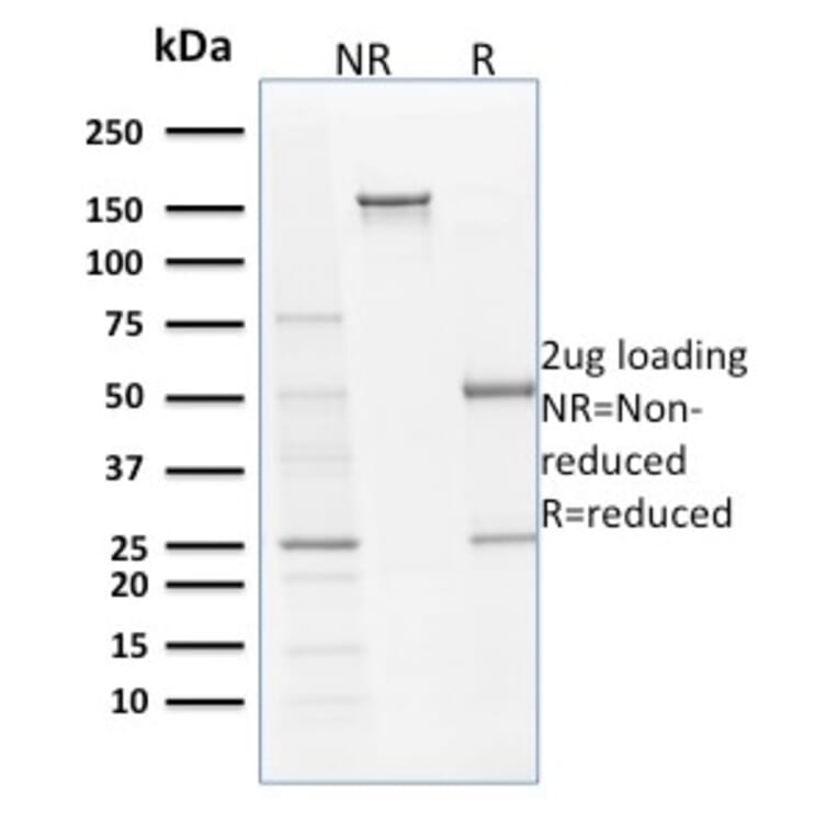 SDS-PAGE - Anti-Filaggrin Antibody [SPM181] (A248544) - Antibodies.com