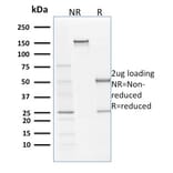 SDS-PAGE - Anti-Filaggrin Antibody [SPM181] (A248544) - Antibodies.com