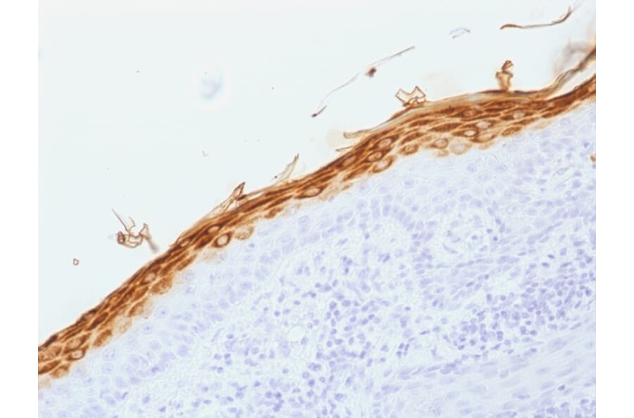 Immunohistochemistry - Anti-Filaggrin Antibody [FLG/1562] (A248544) - Antibodies.com