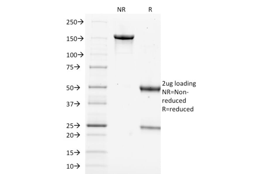 SDS-PAGE - Anti-Filaggrin Antibody [FLG/1562] (A248545) - Antibodies.com