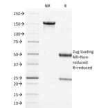 SDS-PAGE - Anti-Filaggrin Antibody [FLG/1562] (A248545) - Antibodies.com