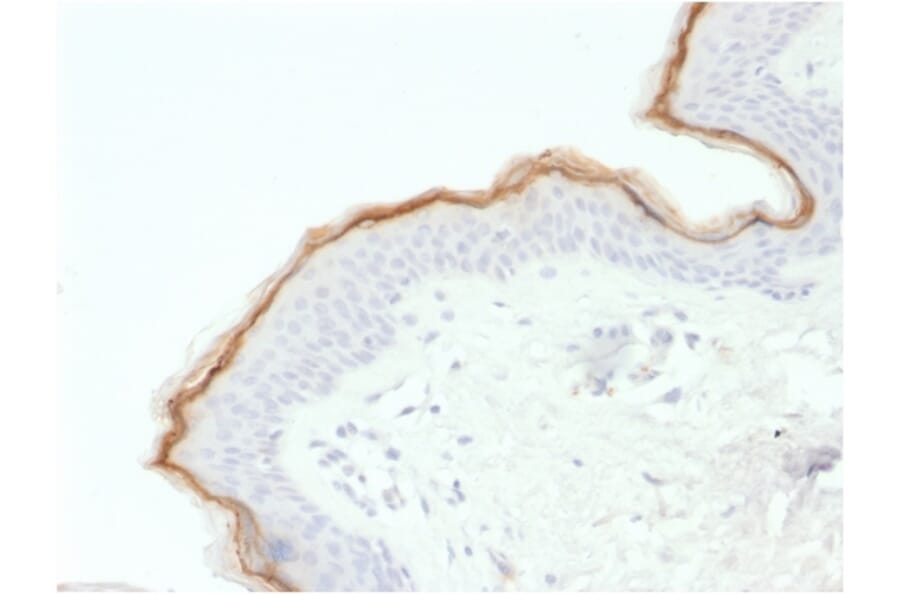 Immunohistochemistry - Anti-Filaggrin Antibody [FLG/1563] (A248546) - Antibodies.com