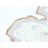 Immunohistochemistry - Anti-Filaggrin Antibody [FLG/1563] (A248546) - Antibodies.com