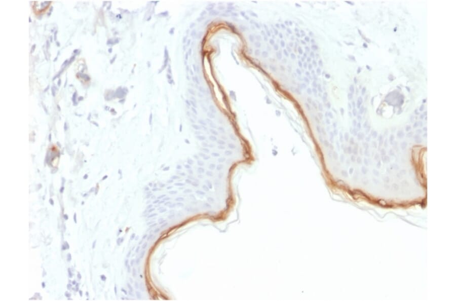Immunohistochemistry - Anti-Filaggrin Antibody [FLG/1945] (A248547) - Antibodies.com