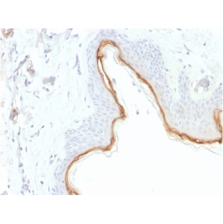 Immunohistochemistry - Anti-Filaggrin Antibody [FLG/1945] (A248547) - Antibodies.com