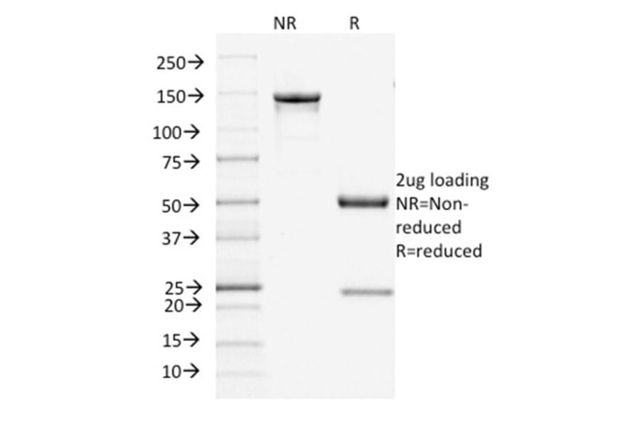 SDS-PAGE - Anti-Filaggrin Antibody [FLG/1945] (A248547) - Antibodies.com