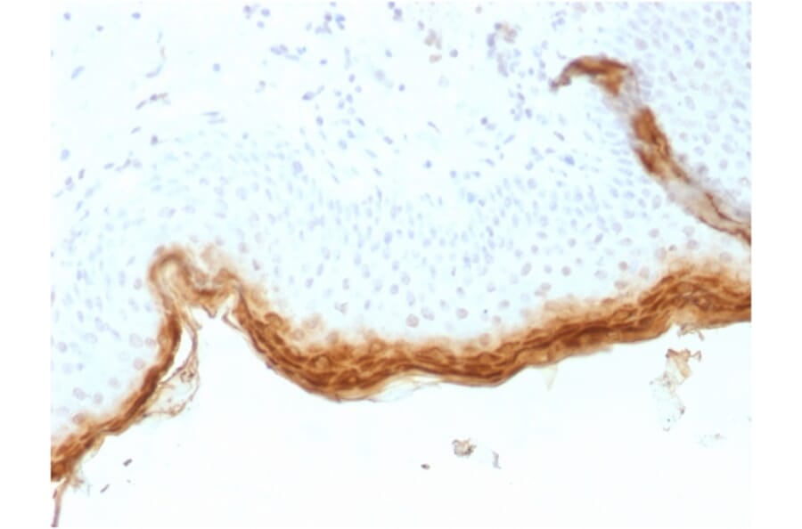 Immunohistochemistry - Anti-Filaggrin Antibody [rFLG/1561] (A248547) - Antibodies.com