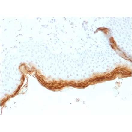 Immunohistochemistry - Anti-Filaggrin Antibody [rFLG/1561] (A248547) - Antibodies.com