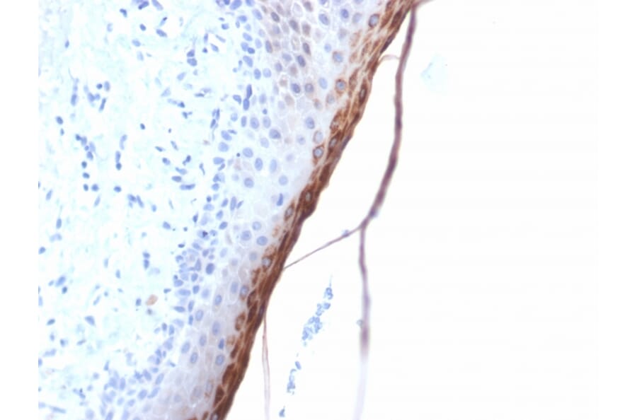 Immunohistochemistry - Anti-Filaggrin Antibody [FLG/1957R] (A248548) - Antibodies.com