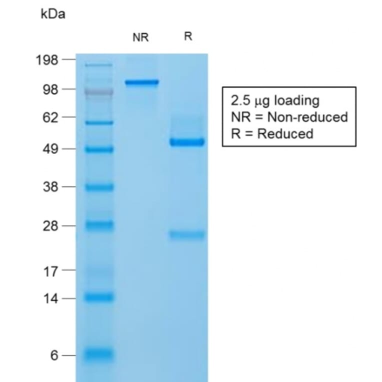 SDS-PAGE - Anti-Filaggrin Antibody [FLG/1957R] (A248549) - Antibodies.com