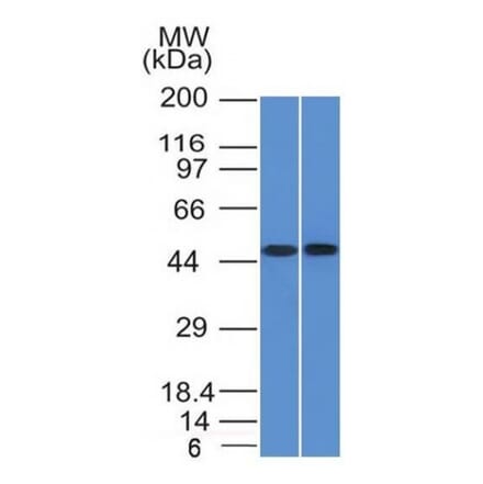 Western Blot - Anti-FLI1 Antibody [FLI1/1312] (A248549) - Antibodies.com