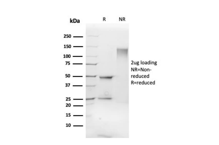 SDS-PAGE - Anti-FLI1 Antibody [FLI1/3183] (A248551) - Antibodies.com