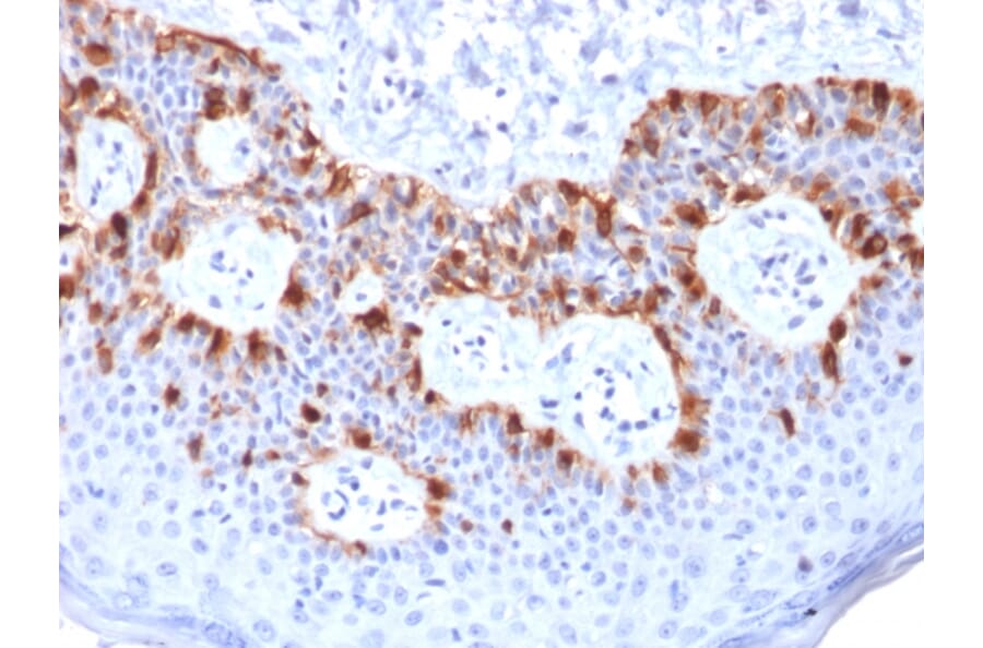 Immunohistochemistry - Anti-MelanA Antibody [rMLANA/788] (A248551) - Antibodies.com